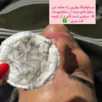 درماپلینگ تخصصی  موخوره گیری  سبک روسی اصلاح ابرو