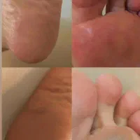 کاشت ناخن، پدیکور و کفسابی و رفع پینه های پا|خدمات آرایشگری و زیبایی|تهران, مشیریه|دیوار