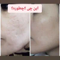 درمان ناهنجاری پوست و آموزش خاویار تراپی|خدمات آرایشگری و زیبایی|شیراز, باهنر|دیوار