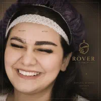 کاشت ابرو با تکنیک سوپر نچرال