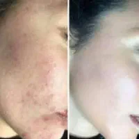 فرمول کرم صورت و دست پاه