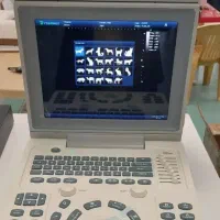 دستگاه سونوگرافی