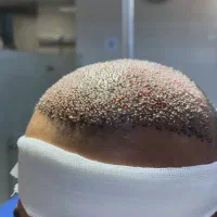 آموزش تخصصی تزریقات زیبایی و لیزر|خدمات آموزشی|اندیشه, اندیشه فاز ۱|دیوار