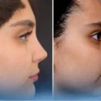 عمل زیبایی|خدمات آرایشگری و زیبایی|تهران, زعفرانیه|دیوار