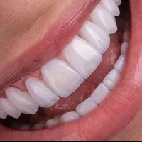 دندانپزشکی|خدمات آرایشگری و زیبایی|کوهدشت, |دیوار