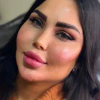 آموزش فشیال طب سنتی فیلر ژل بوتاکس نخ لیفت لیزر مو|خدمات آموزشی|اصفهان, باغ زرشک|دیوار