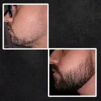 رشد ریشتو 10 برابر کن