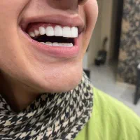 آموزش تخصصی کامپوزیت دندان با برد تخصصی|خدمات آموزشی|اندیشه, شهرک کوثر|دیوار