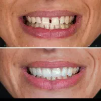 نیازمند اجاره یونیت میکرویونیت در کلینیک