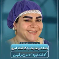 مدل کاشت ابرو فقط ۱۰ میلیون