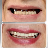 خدمات درمانی دندان اقساطی