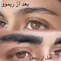 ریموو تخصصی تتو با مواد گیاهی اروپا تک جلسه|خدمات آرایشگری و زیبایی|تهران, دهکده المپیک|دیوار