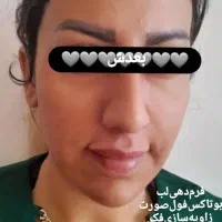 مدل ژل بوتاکس و پیرسینگ|خدمات آرایشگری و زیبایی|فولادشهر, مسکن مهر فولادشهر|دیوار