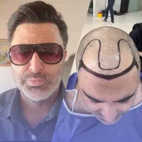 تخفیف ویژه کاشتمو در شیراز با اقامت رایگان