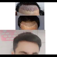 کاشت تخصصی مو وابرو|خدمات آرایشگری و زیبایی|یاسوج, |دیوار