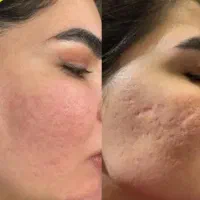 مزو ندلینگ|خدمات آرایشگری و زیبایی|مشهد, دانشجو|دیوار