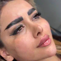 کلینیک تزریق ژل و بوتاکس مزو آنزیم فیلر