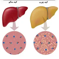 کبد پالایشگاه و پلیس راه بدن حالش را خوب کن