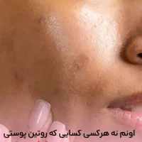 راهنمایی برای پوست|فعالیت داوطلبانه|قم, زنبیل آباد|دیوار