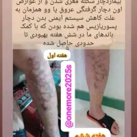 درمان با باند گیاهی|آرایشی، بهداشتی، درمانی|مشهد, آزادشهر|دیوار