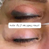 تخفیف ۴۰ درصدی ریموو ومیکرو ابرو برای ۵ نفر اول|خدمات آرایشگری و زیبایی|ورامین, ورامین|دیوار