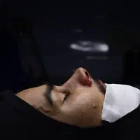پیکرتراشی لیپوماتیک ۴۵ م آبدو مامو پروتز لیفت لیپو|خدمات زیبایی و سلامت|تهران, تهرانپارس جنوبی|دیوار