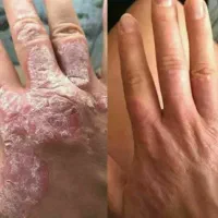 کارباگوشی مخصوص بانوان درمنزل|استخدام بازاریابی و فروش|سردشت, |دیوار