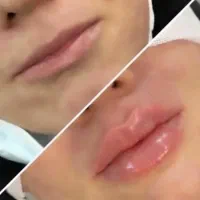 ارائه خدمات زیبایی درمانی با50%تخفیف