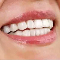 عصب ‌کشی دندان‌های قدامی ( جلو )
