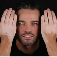 پیسی وویتیلیگو|آرایشی، بهداشتی، درمانی|تیکمه داش, |دیوار