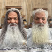 پروتز مو روشی نوین جایگزین کاشت مو