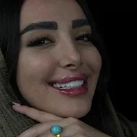 کامپوزیت فکی۵میلیون عصبکشی۹۰۰تمام‌خدمات دندان قسط|خدمات آرایشگری و زیبایی|کرج, گوهردشت|دیوار
