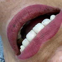 جشنواره دندانپزشکی زیبایی و درمانی|خدمات آرایشگری و زیبایی|تبریز, |دیوار