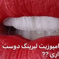 آموزش کامپوزیت دندان تخفیف ۵۰ درصدی|خدمات آموزشی|اندیشه, |دیوار