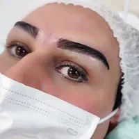 کاشت ابرو در گلپایگان