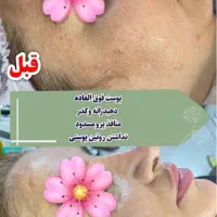 خدماتVIPپوست فشیال پاکسازی و اسکالپ سر وخال برداری