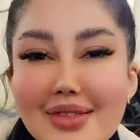 4 سی سی تزریق فیلر یک سی سی فیلر رایگان|خدمات آرایشگری و زیبایی|تهران, نیروی هوایی (پیروزی)|دیوار