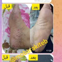 پوست و مو|آرایشی، بهداشتی، درمانی|آستانه اشرفیه, |دیوار