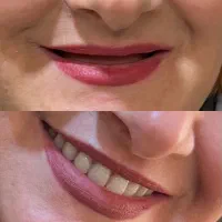 مرکز تخصصی دندانسازی/کنترل تضمینی لقی دندان مصنوعی|خدمات زیبایی و سلامت|تهران, افسریه شمالی|دیوار