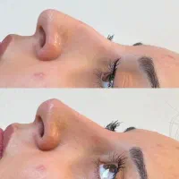 مطب پوست مو تزریق بوتاکس فیلر مزوتراپی هایفو|خدمات آرایشگری و زیبایی|محمدشهر, محمدشهر|دیوار