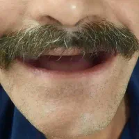 دندان مصنوعی در محل شما با کیفیت تضمینی|خدمات آرایشگری و زیبایی|هشتگرد, شهرک ریحانه|دیوار