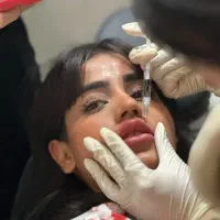 تزریق فیلر از 550 ت و آموزش تخصصی فیلر و بوتاکس