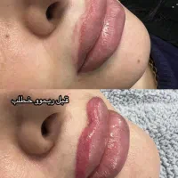 شیدلب / خطچشم دائم / میکروبلیدینگ / فیبروز / ریموو|خدمات آرایشگری و زیبایی|رشت, استادسرا|دیوار