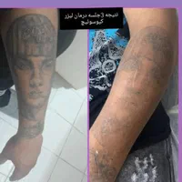 پاک کردن تتوخالکوبی/بدن ابرو لب چشم/بوتاکس کیوسویچ|خدمات آرایشگری و زیبایی|اصفهان, عباسآباد|دیوار