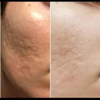 انجام خدمات زیبایی زنان|خدمات آرایشگری و زیبایی|تهران, شهرک شریعتی|دیوار