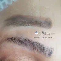 خدمات تخصصی ریموو تتو و آرایش دائم