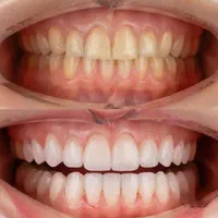 لابراتوار پرتزهای دندانی و دندانسازی پرشین