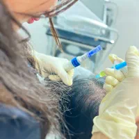 مزوتراپی و مزونیدلینگ مو درمان ریزش مو و رویش مجدد|خدمات آرایشگری و زیبایی|قائم‌شهر, |دیوار