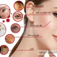 جشنواره پی آرپی