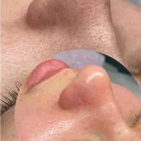 پاکسازی پکیج ویژه